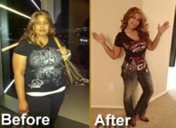 Gastric Bypass Surgery San Antonio Success Story Patient Stacy